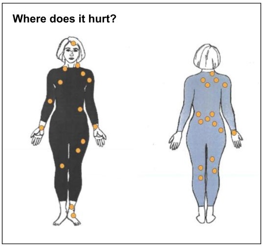 Body images with caption "Where does it hurt?"